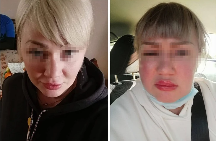 Ангарчанка стала жертвой косметолога Ангарчанка стала жертвой косметолога